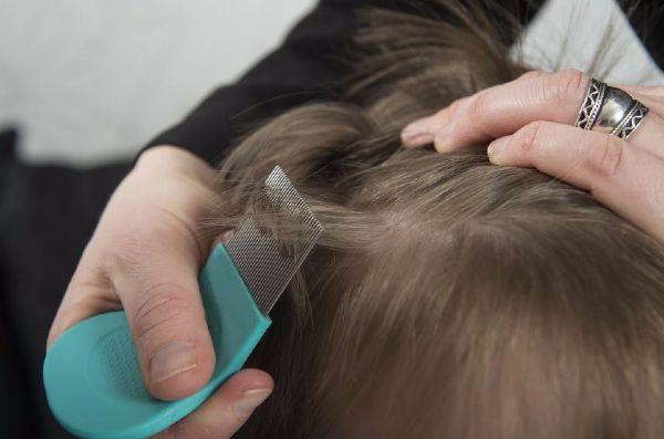 Experts issue warning over ‘indestructible’ super lice