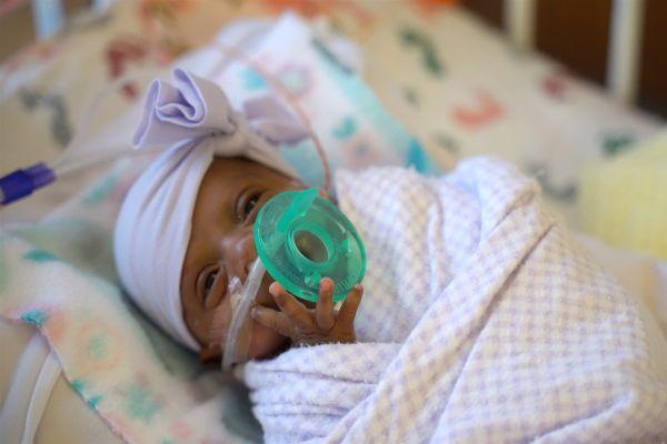 The worlds smallest surviving baby leaves hospital after five months