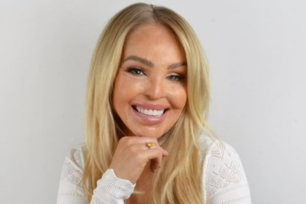 Katie Piper has released her first children’s book and it’s inspiring